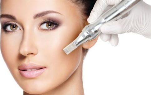 Advanced SkinNeedler